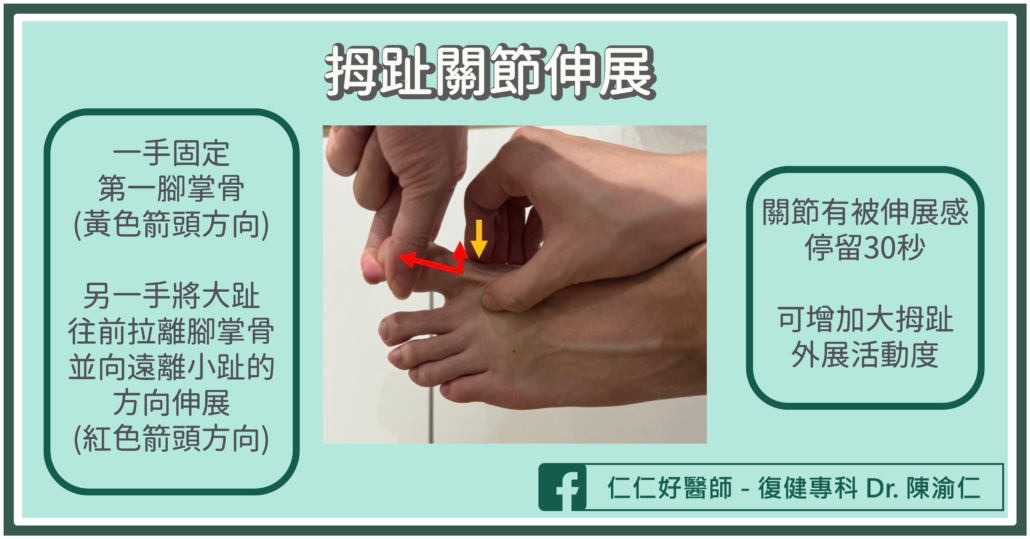 拇趾外翻怎麼辦?治療處置全解析 – 仁生復健科診所